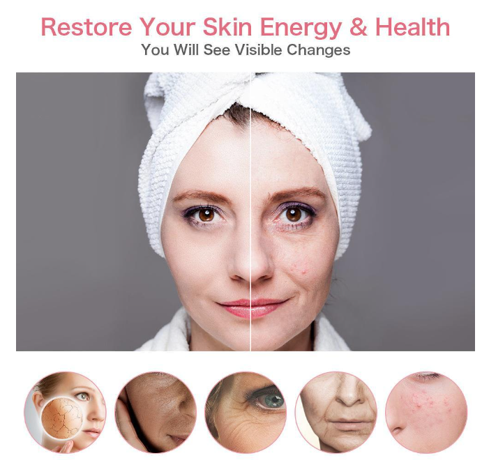 VELORA Facial Beauty Ion Device — Pink, White & Black
